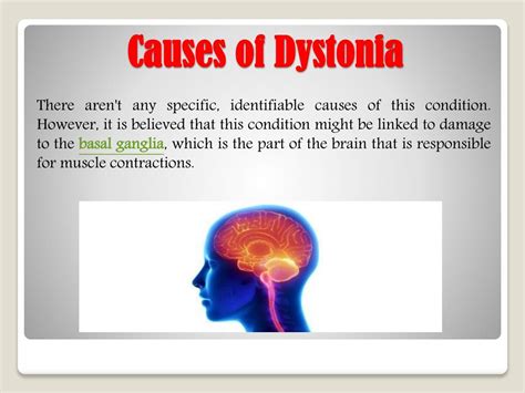 The ANS is charge of involuntary functions—things that happen without thinking—like breathing. . Dystonia life expectancy